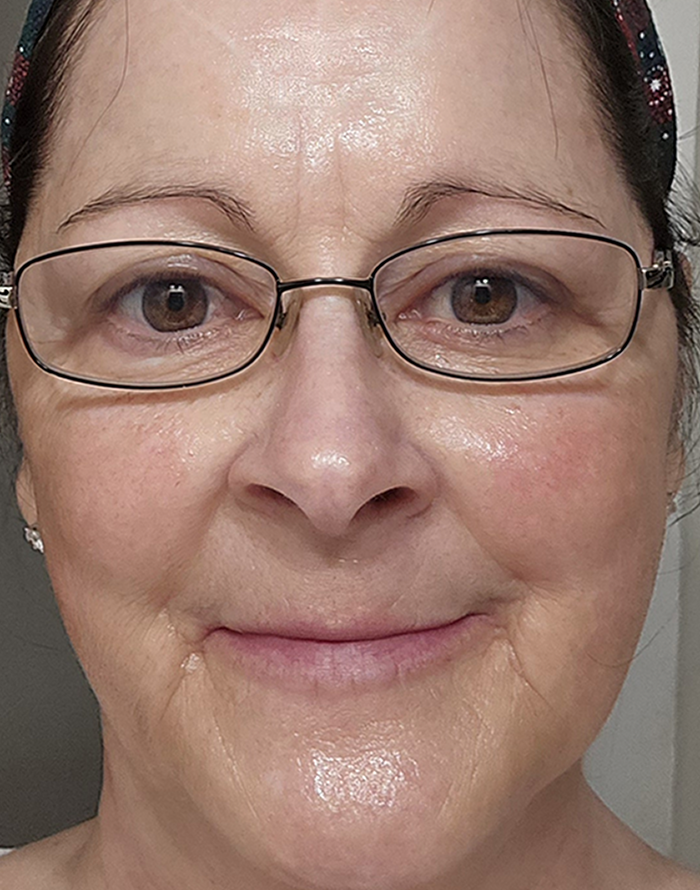 after testimonial card