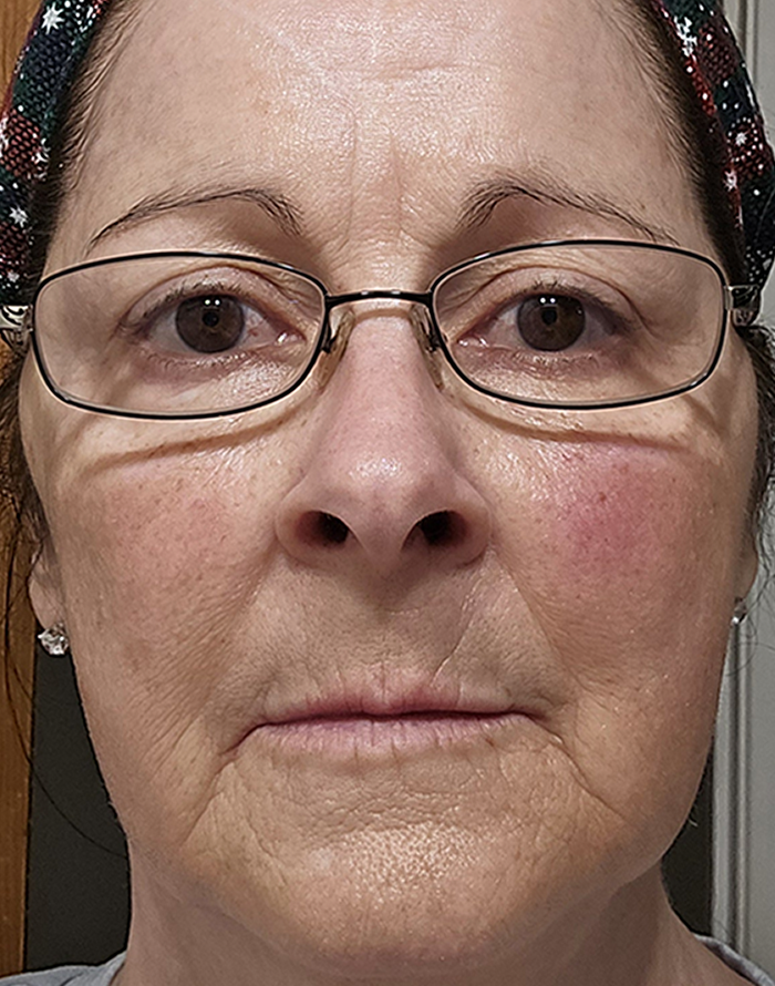 before testimonial card